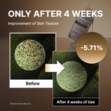 NIDA Black Rice Blackhead Exfoliating Serum